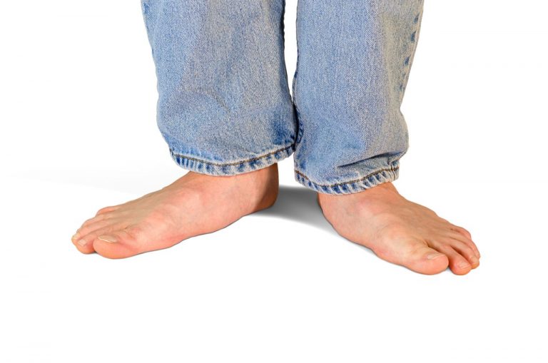Flatfoot Pain The Trouble with Low Arches Dallas Podiatry Works