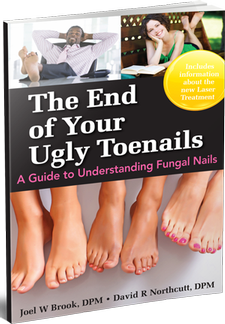 Free Guide Explaining Fungal Nails
