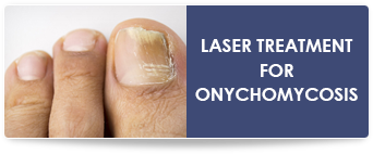 plano foot specialists, laser toenail fungus treatment