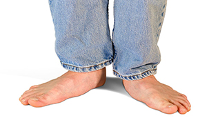 How to Correct Flat Feet