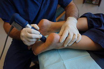 dallas foot specialist epat therapy