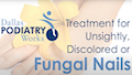 treatment for ugly discolored fungal toes